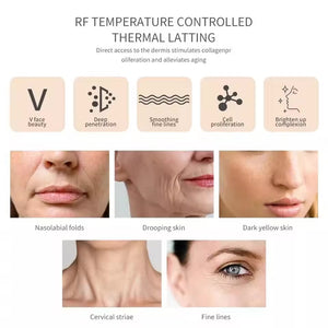 RF Facial Lifting & Skin Tightening Machine